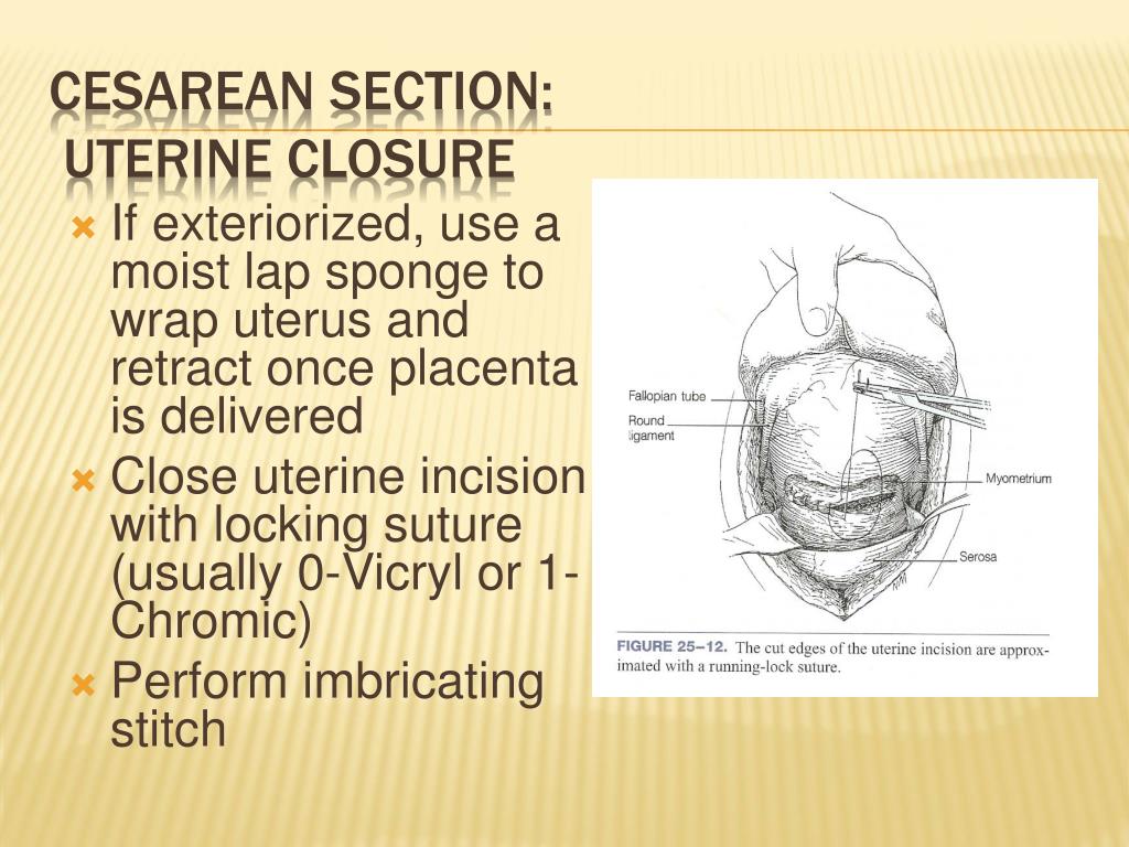 cesarean section clinical presentation