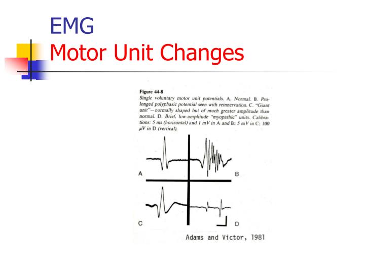 PPT Introduction to EMG for Anesthesiologists and Pain Control