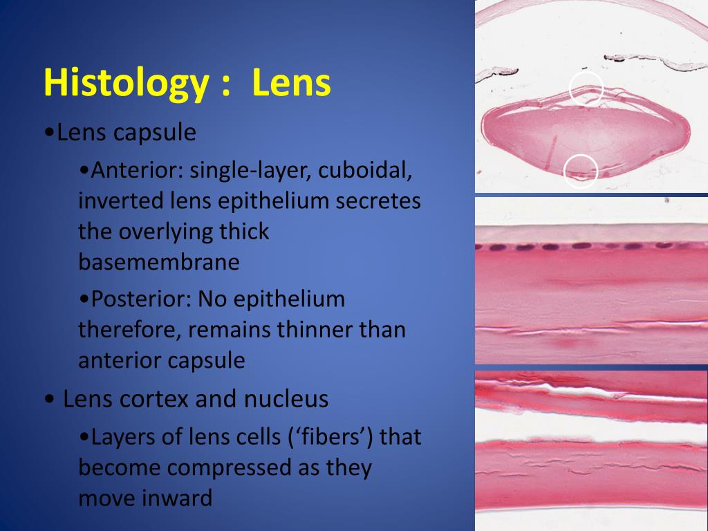 PPT Ophthalmic Pathology PowerPoint Presentation, free download ID