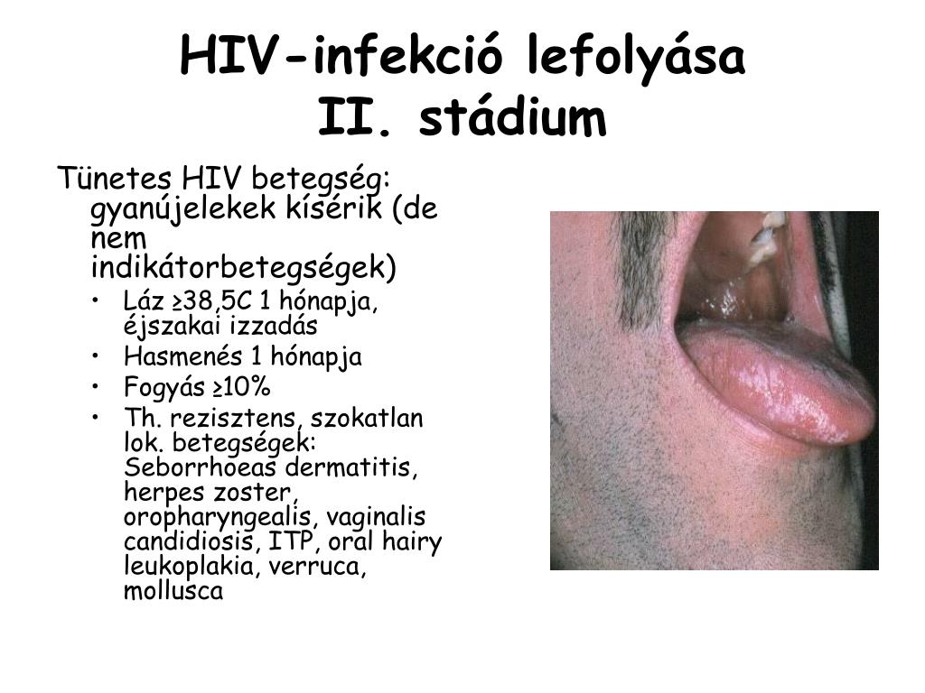 hiv fogyás)