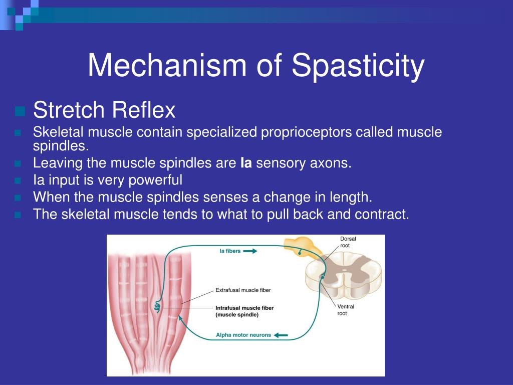Ppt Definitions And Pathophysiology Of Spasticity Powerpoint | My XXX ...