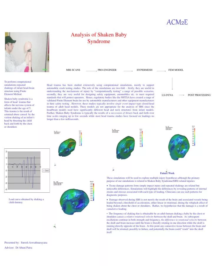 analysis of shaken baby syndrome n.