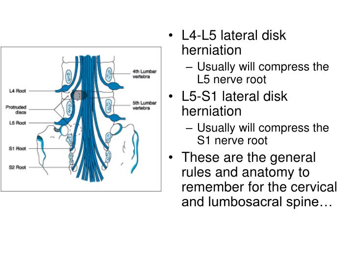 PPT - Cervical and low back pain and radiculopathy PowerPoint