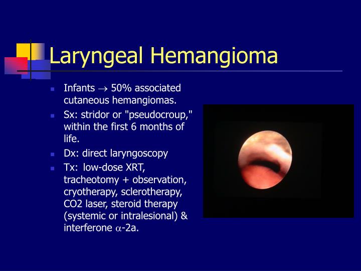 PPT - Diseases of the Larynx PowerPoint Presentation - ID:1255018