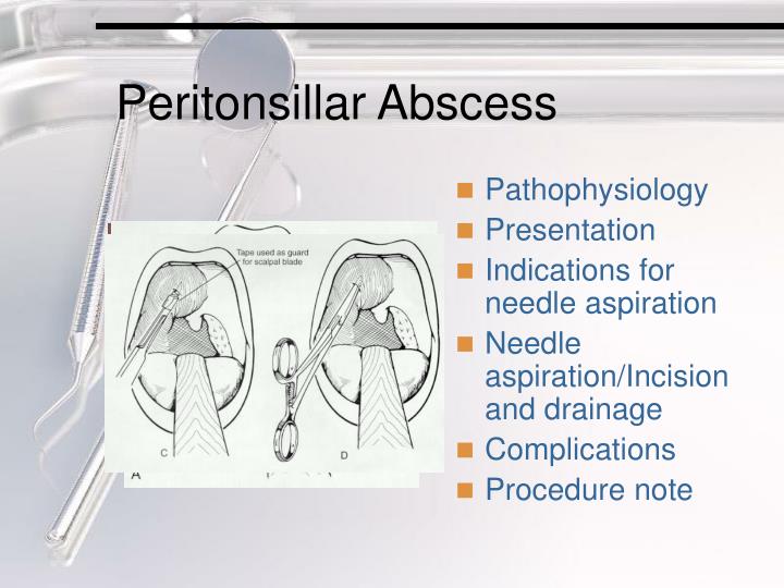 PPT Otolaryngologic Procedures PowerPoint Presentation ID1257227