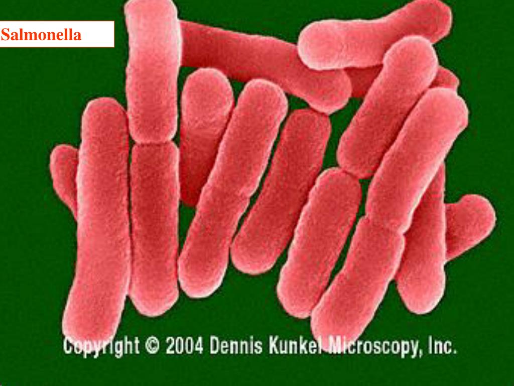 Сальмонеллез и брюшной тиф. Возбудитель паратифа. Salmonella анаэроб. Сальмонелла паратифи. Паратиф бактерия.