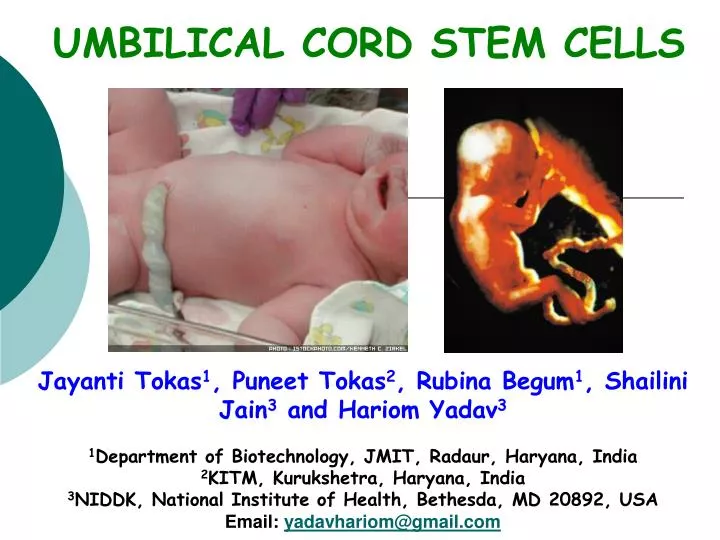 Ppt 5 Reasons For Preserving Stem Cells In Umbilical Cord Powerpoint Presentation Id 7947339