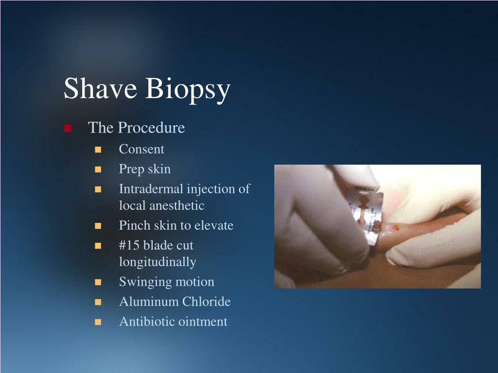 PPT Dermatological Assessment and Procedures PowerPoint Presentation