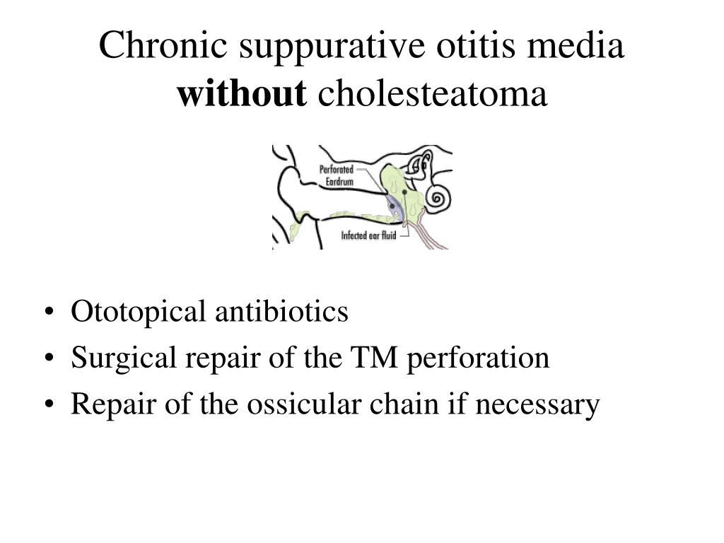 Ppt Chronic Otitis Media Com With And Without Cholesteatoma Pathophysiology Diagnosis And
