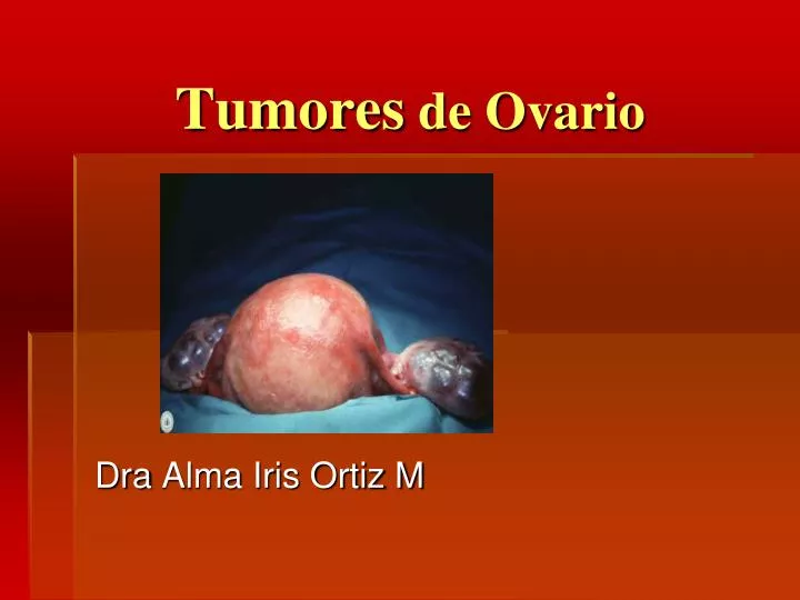 quistes funcionales de ovario slideshare quistes funcionales de ovario slideshare