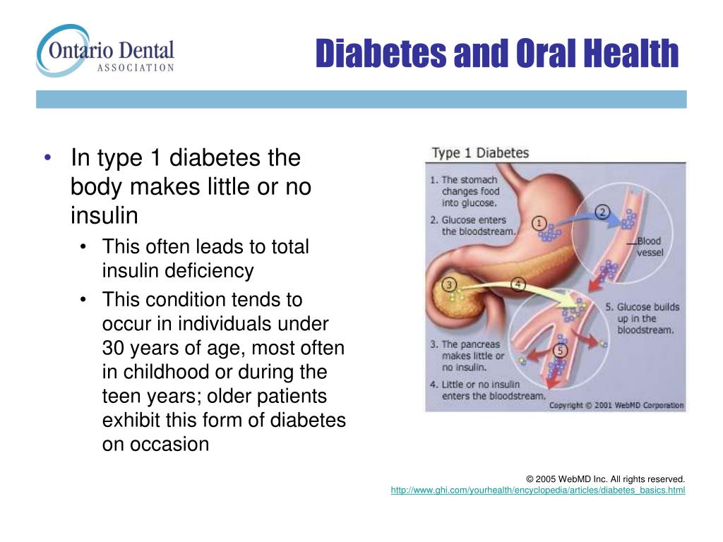 oral presentation of diabetes