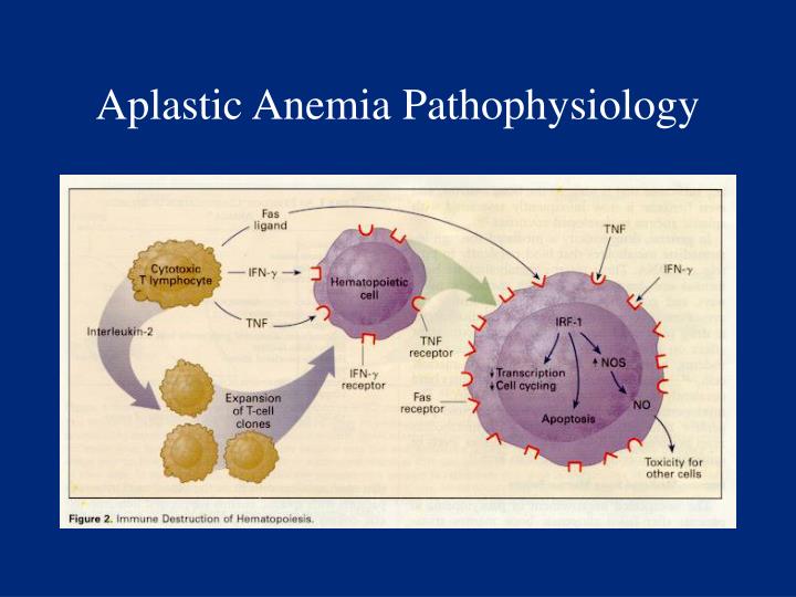 PPT - Aplastic Anemia PowerPoint Presentation - ID:1296182