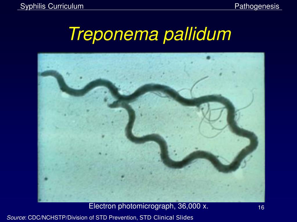 Бледная трепонема treponema pallidum. Сифилис трепонема паллидум. Спирилла бледная трепонема.
