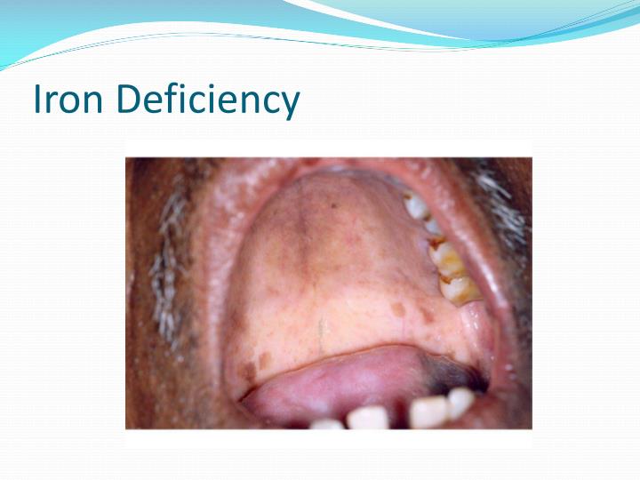 PPT Health, Oral Health, and Elderly Quality of Life PowerPoint Presentation ID1304070