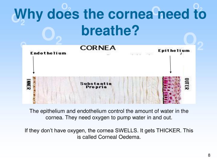 PPT Corneal Oxygen Deficiency PowerPoint Presentation ID1309617