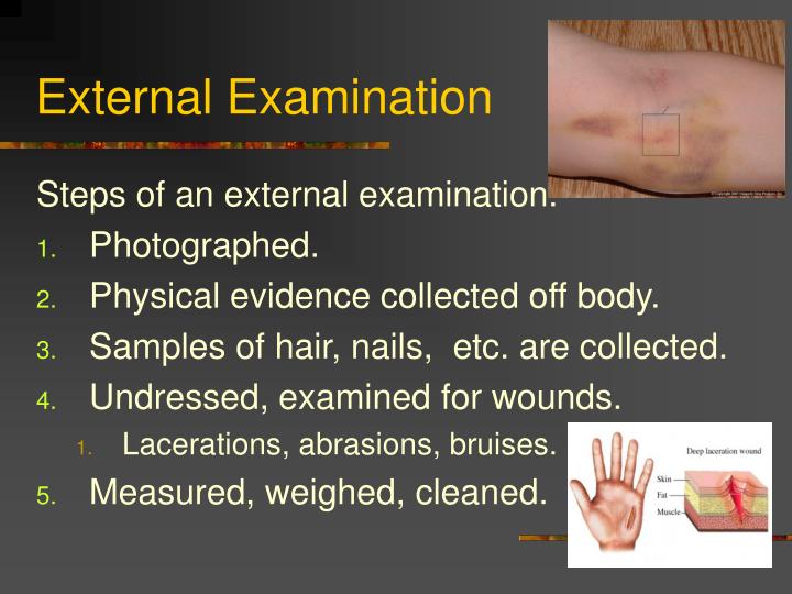 ppt-the-forensic-autopsy-powerpoint-presentation-id-1316679