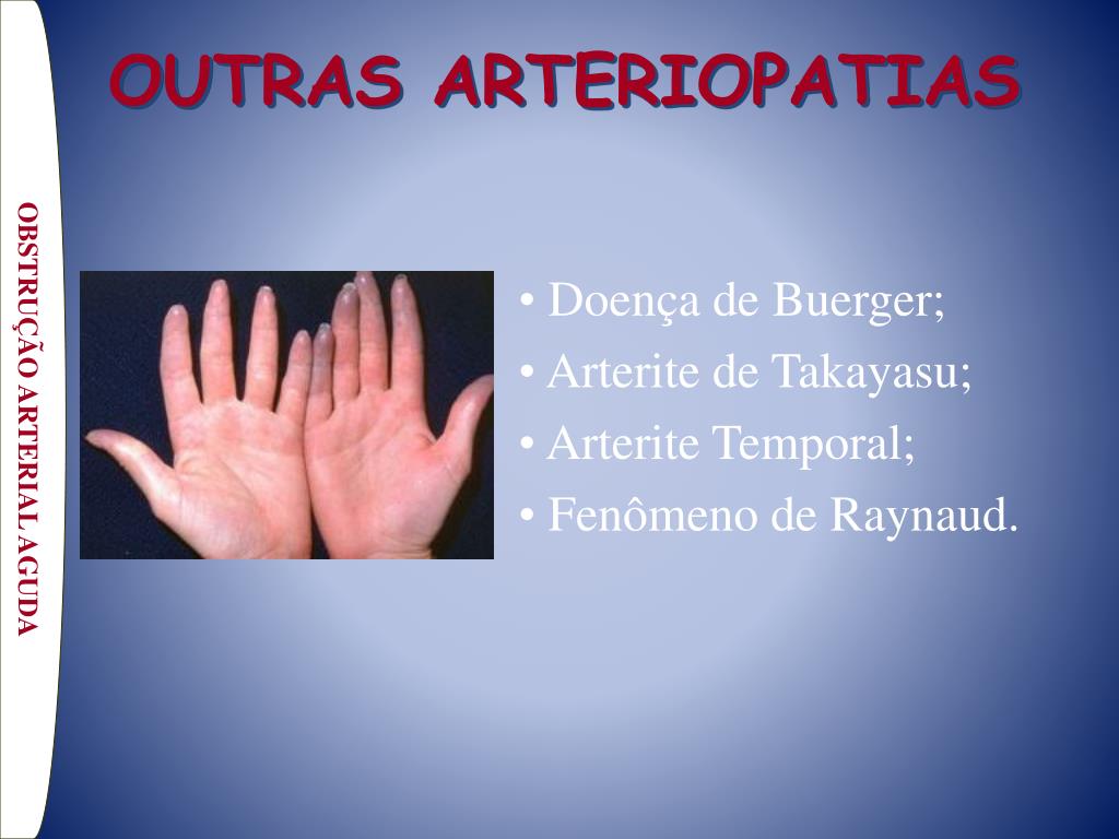 Facada na articulação da parte superior da perna