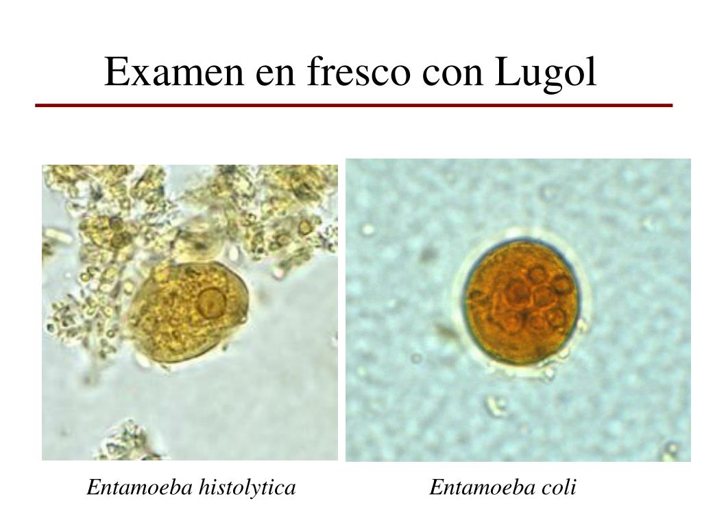 Entamoeba coli в кале. Entamoeba histolytica циста. Entamoeba histolytica под микроскопом. Цисты Entamoeba. Entamoeba coli циста.