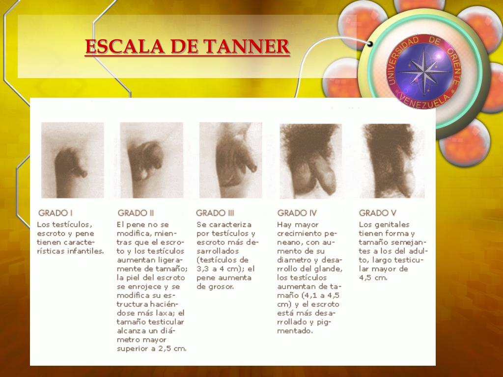 Tanner Scale Tanner Staging OHMZAW Tanner Scale Tanner Staging OHMZAW