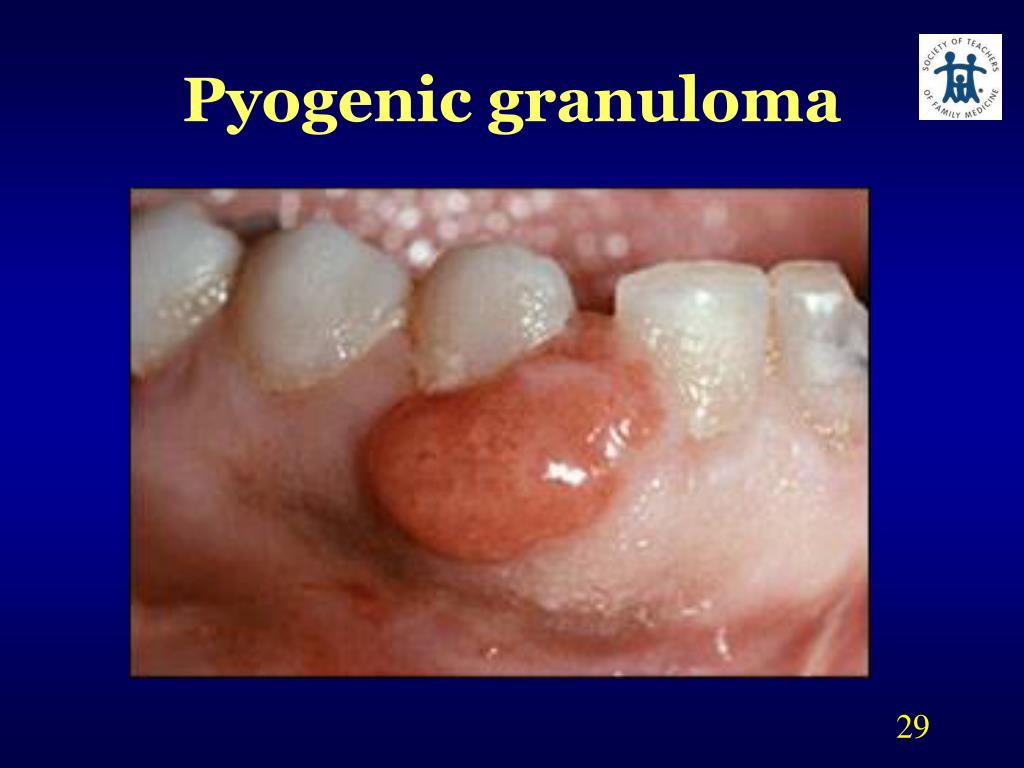 PPT Interdisciplinary Oral Health PowerPoint Presentation Free PPT Interdisciplinary Oral Health PowerPoint Presentation Free