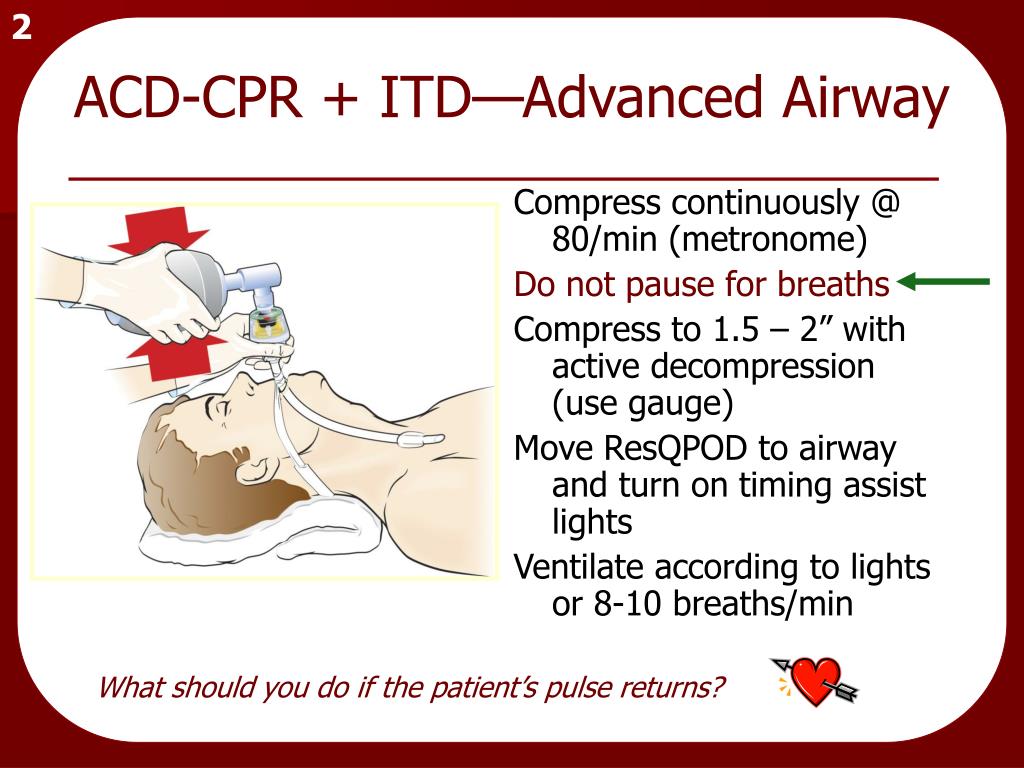 Двигатель CPR технические характеристики. Что означает CPR В медицине. RESQPUMP.