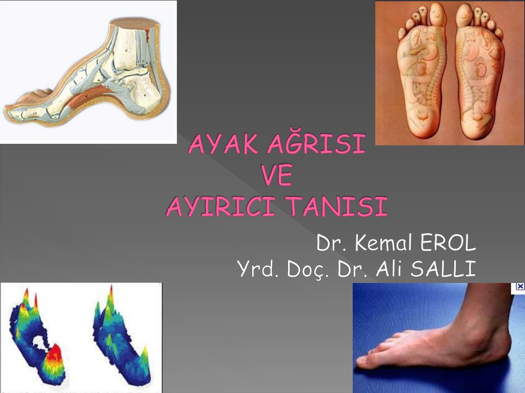 Ayak Ağrısı Neden Olur Ayak Ağrısı Neden Olur