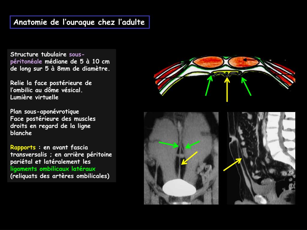 PPT Marion GRANDHAYE IHN PowerPoint Presentation Free Download ID PPT Marion GRANDHAYE IHN PowerPoint Presentation Free Download ID
