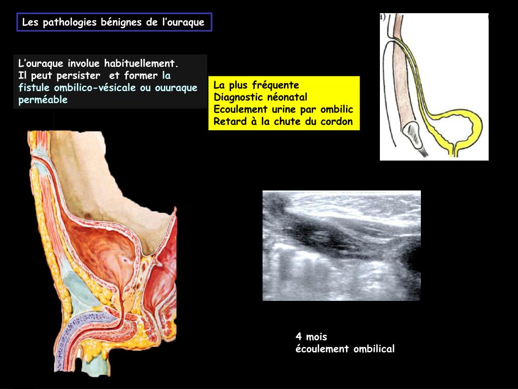 PPT Marion GRANDHAYE IHN PowerPoint Presentation Free Download ID PPT Marion GRANDHAYE IHN PowerPoint Presentation Free Download ID
