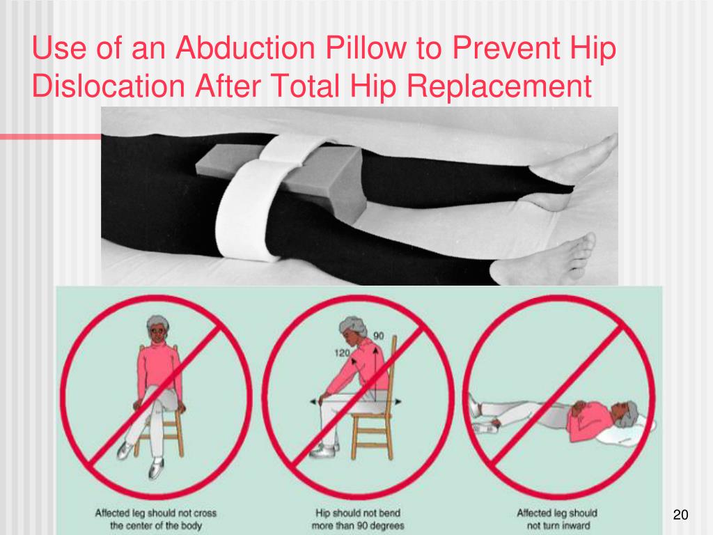 Abduction pillow after total hip cheap replacement