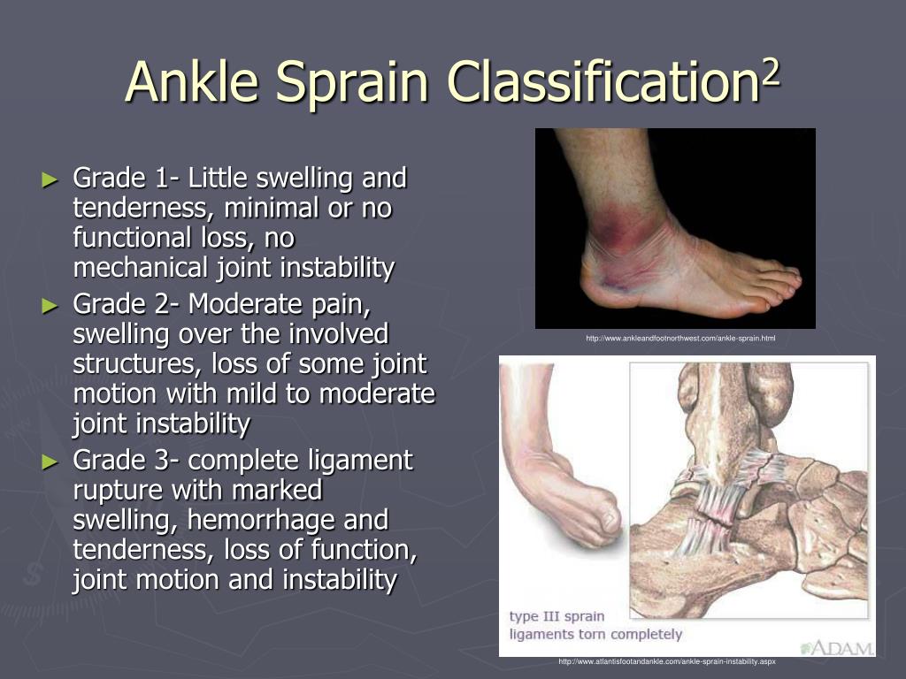 PPT - Lateral Ankle Pathology PowerPoint Presentation, free download ...