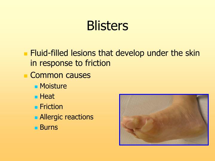 PPT Common Skin and Nail Conditions in Podiatric