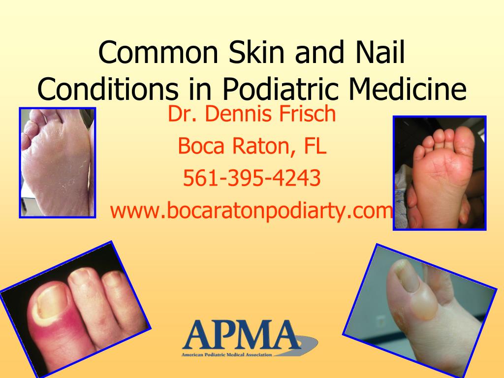 How to Identify and Address Your Toenail Problems - The Foot Doc™