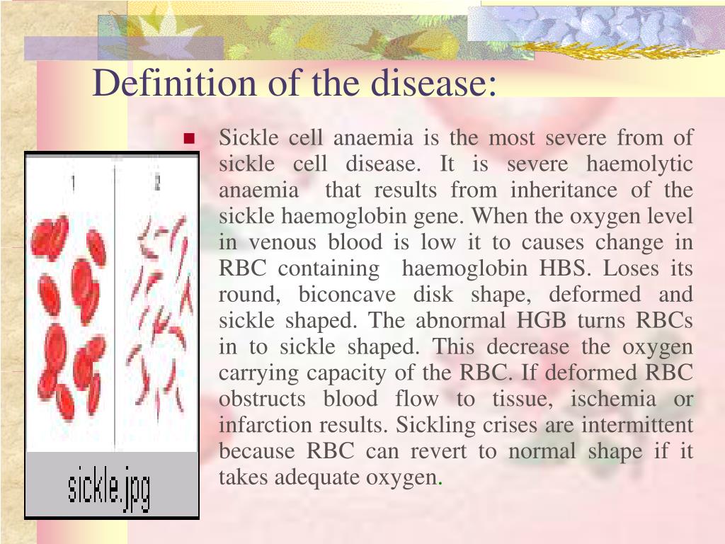 sickness definition