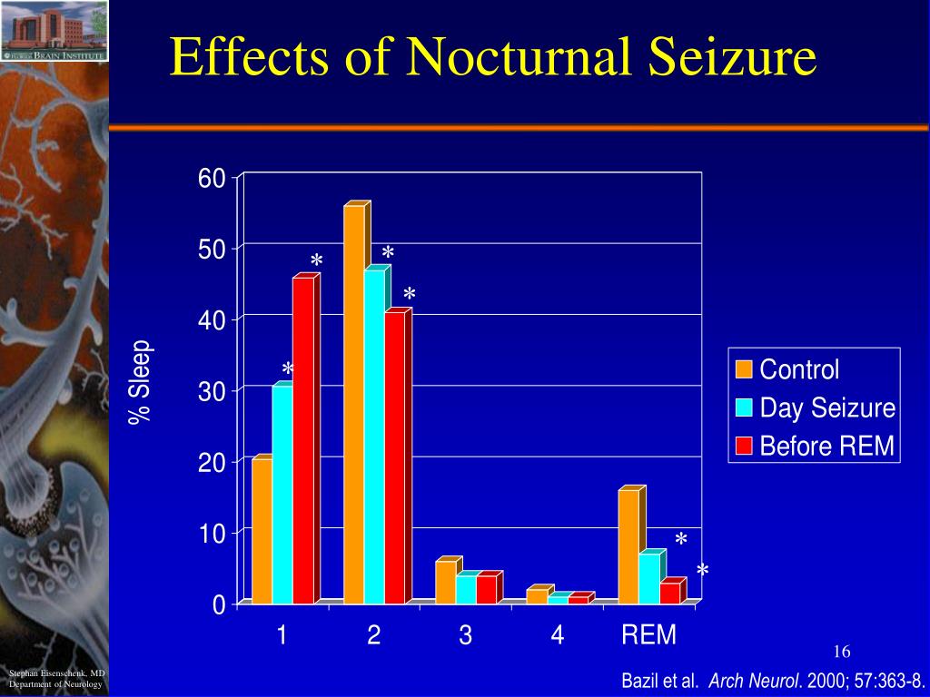 nocturnal epilepsy and sleepimg till 2pm nocturnal epilepsy and sleepimg till 2pm
