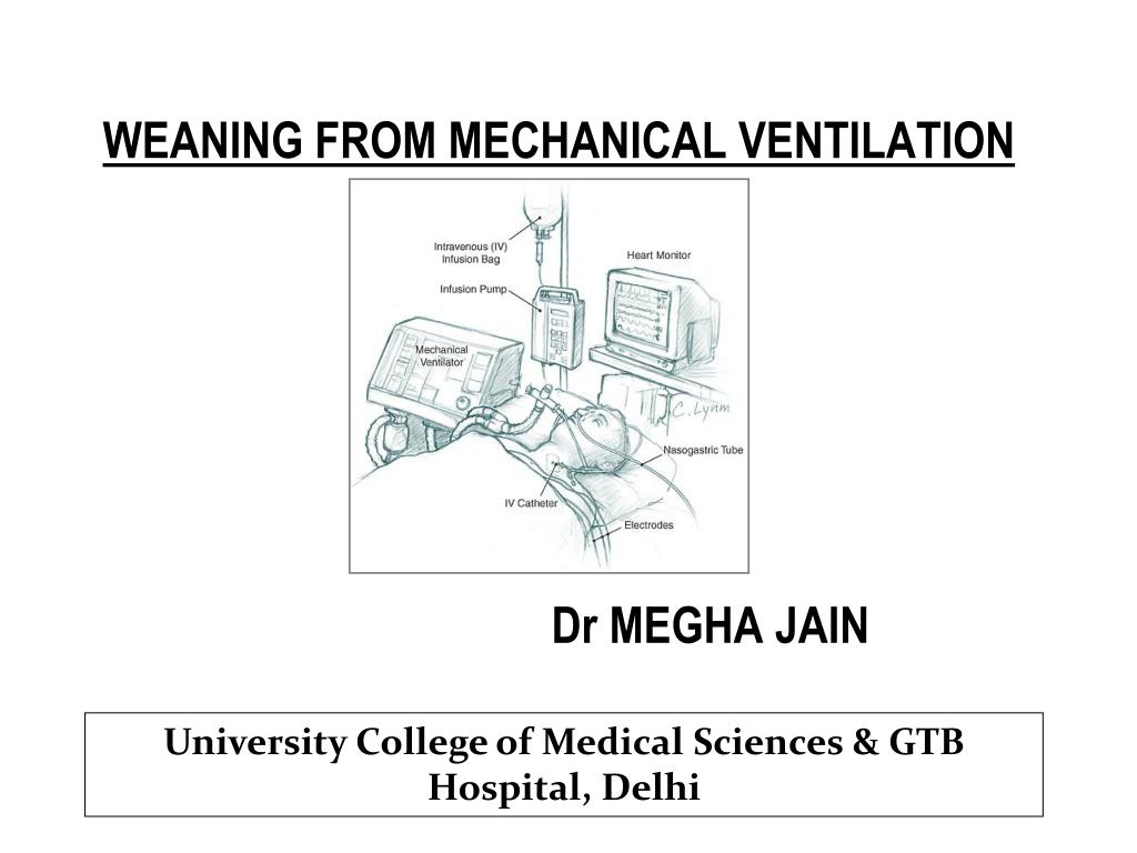 PPT - WEANING FROM MECHANICAL VENTILATION PowerPoint Presentation, free  download - ID:1366992