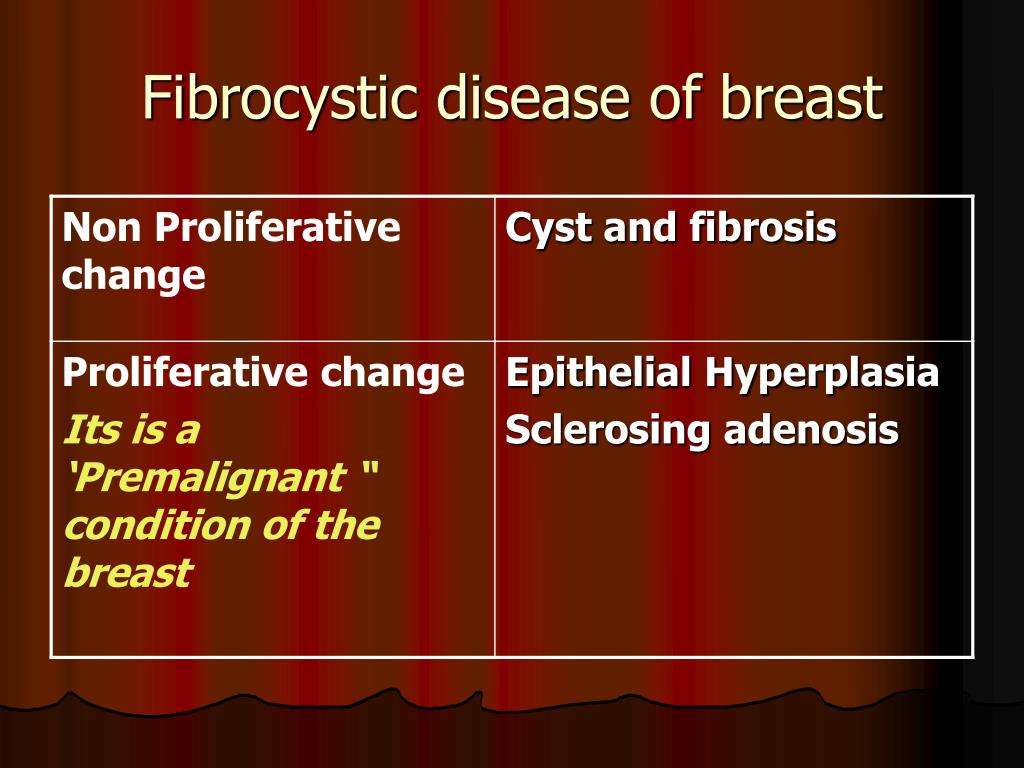 fibrocystic breast changes ncbi