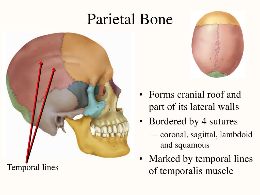 The bones form. Parietal кость. Bone Sutures. Parietal Ridge. Temporal line Bone.