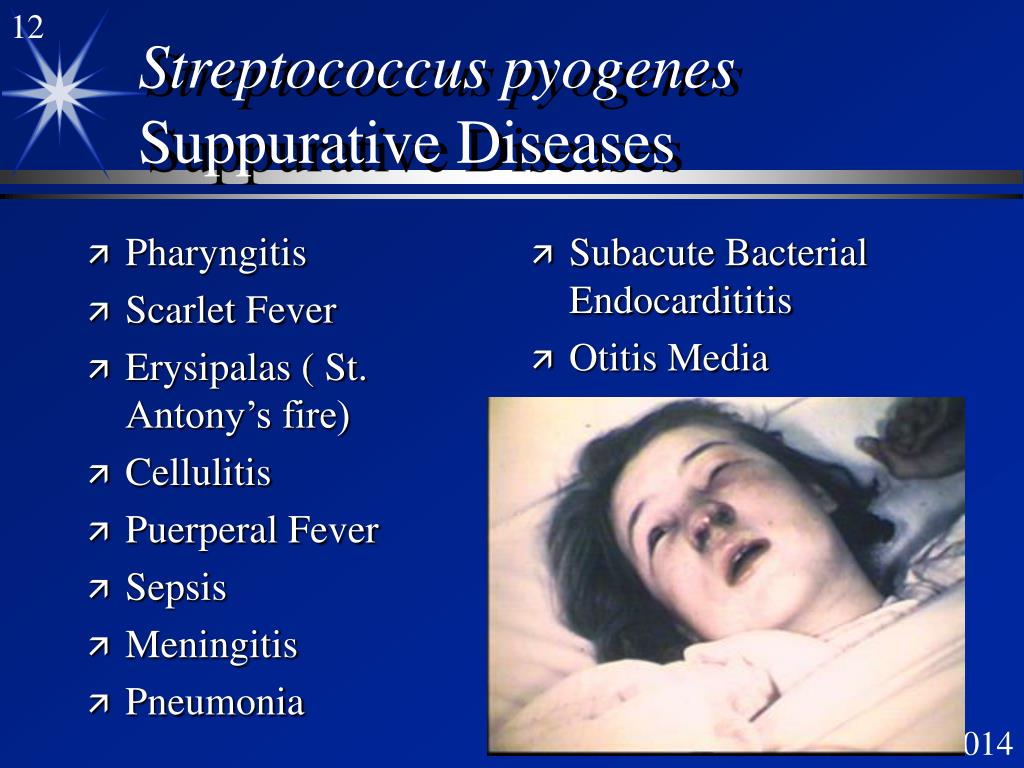 Ppt Streptococcus Powerpoint Presentation Free Download Id1374758