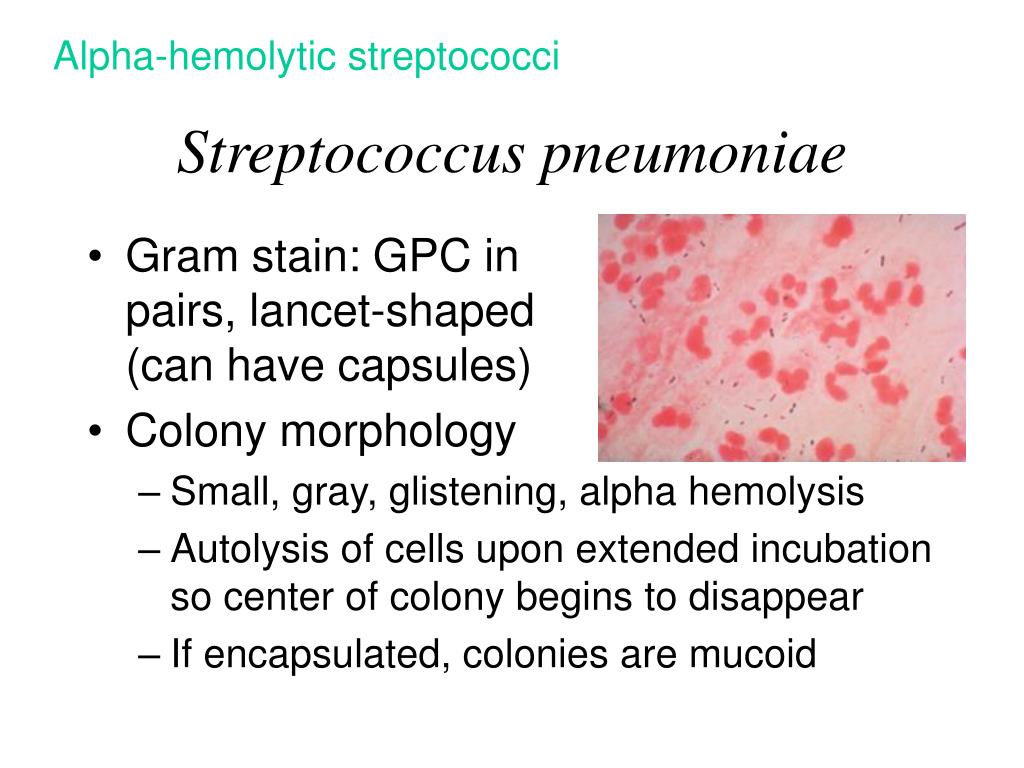 streptococcus pneumoniae.