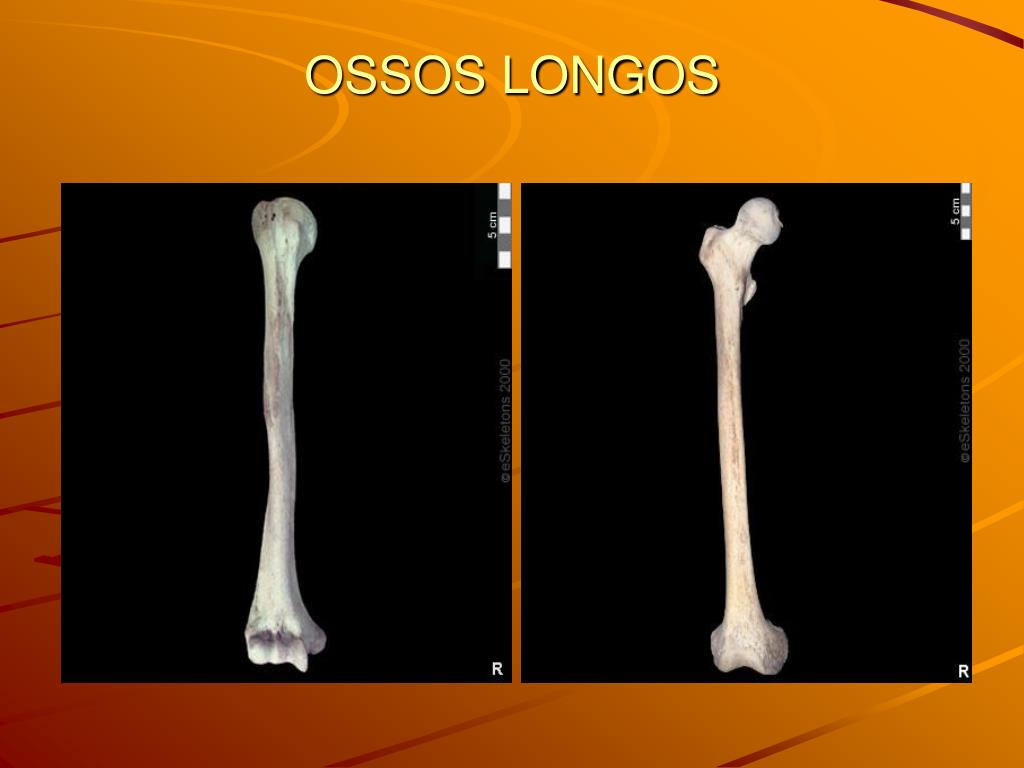 Aula Prática sobre Aparelho Locomotor - Porção Passiva - Osteologia do  Membro Torácico - Cintura Escapular e Braço