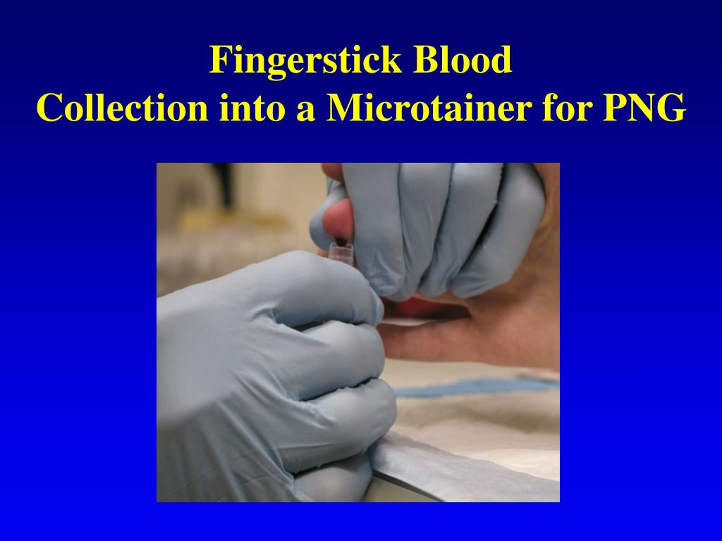 PPT Fingerstick Blood Collection into a Microtainer for PNG