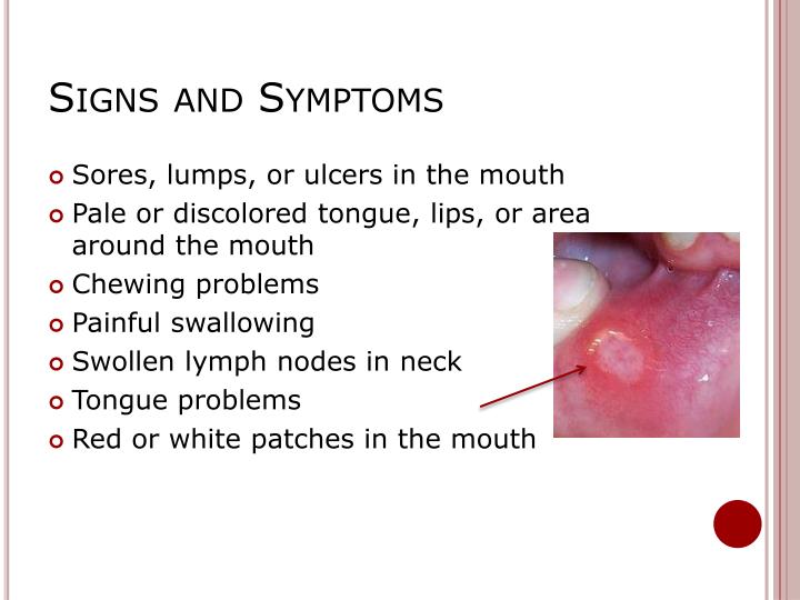 PPT Oral Hygiene, Diet, and Oral Cancer PowerPoint