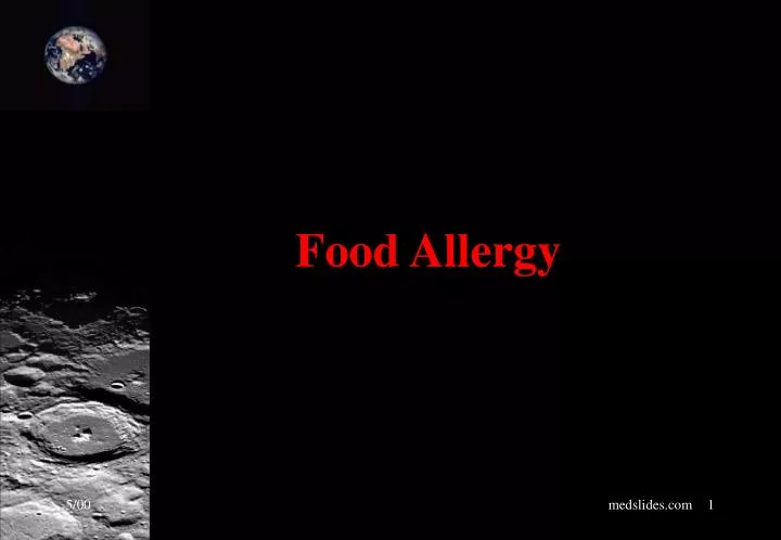 PPT Food Allergy PowerPoint Presentation, free download