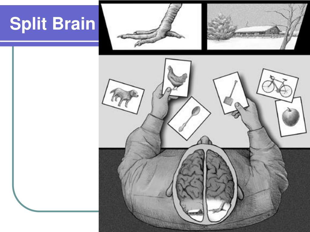 Split brain