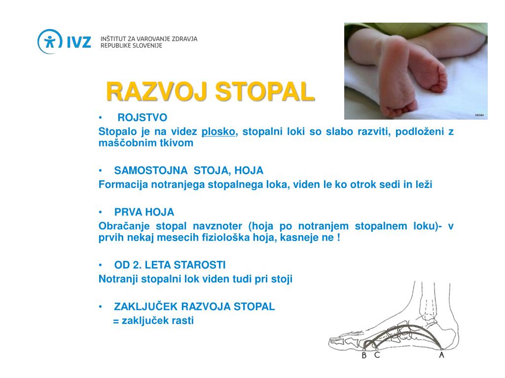 PPT - MALA ŠOLA ZDRAVE HRBTENICE PowerPoint Presentation, free download -  ID:1406319