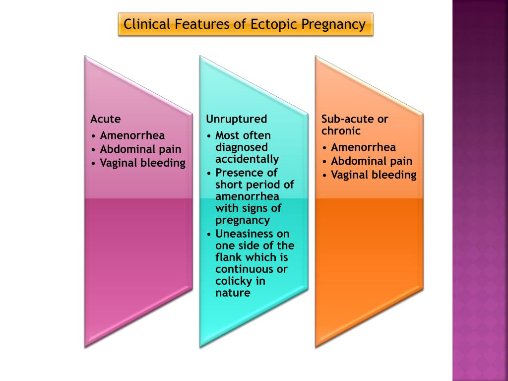 presentation of ectopic pregnancy