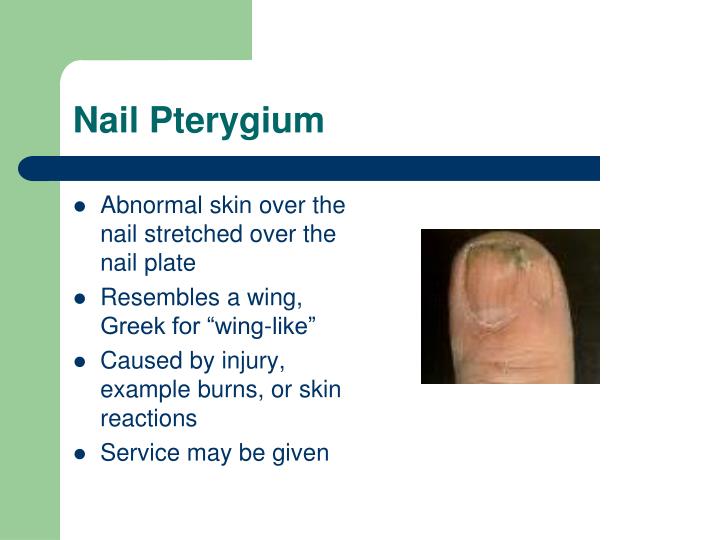 Pterygium Nail Disorder Symptoms - Nail Ftempo