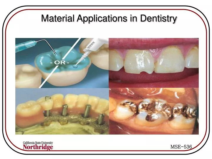 Ppt Material Applications In Dentistry Powerpoint Presentation Free Download Id 1411911