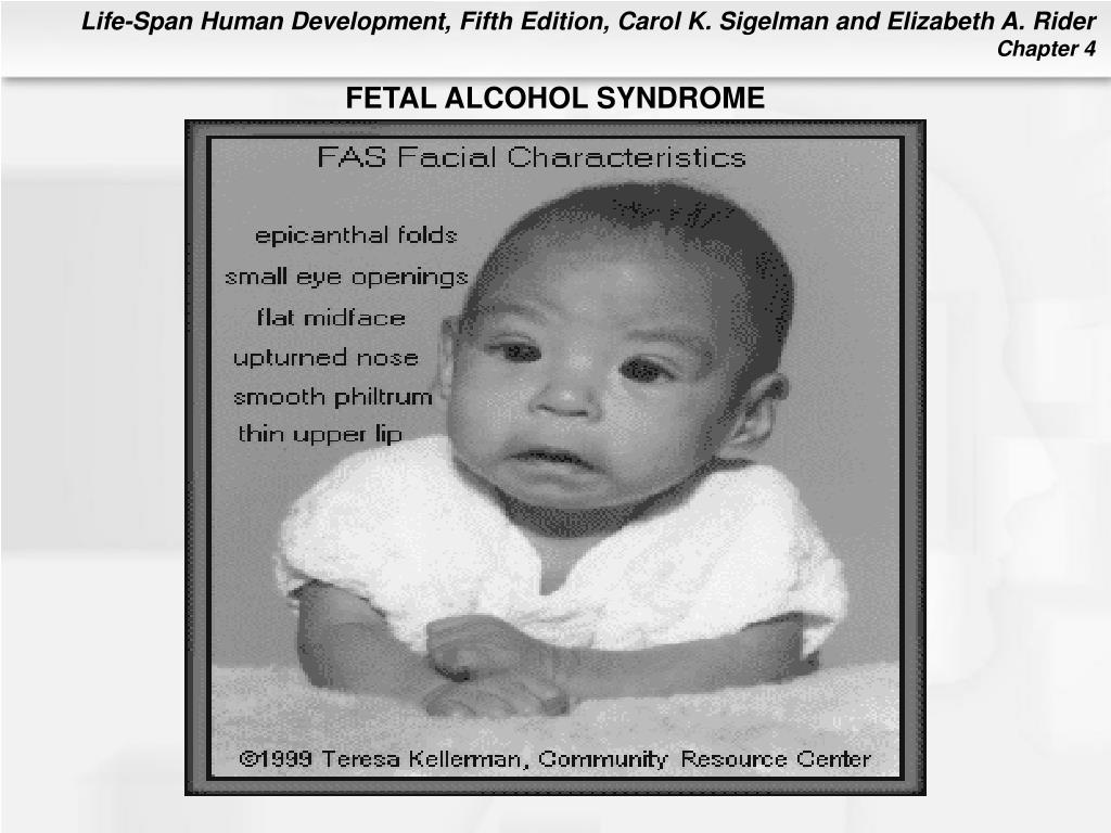 PPT - Chapter 4 Prenatal Development and Birth PowerPoint Presentation ...