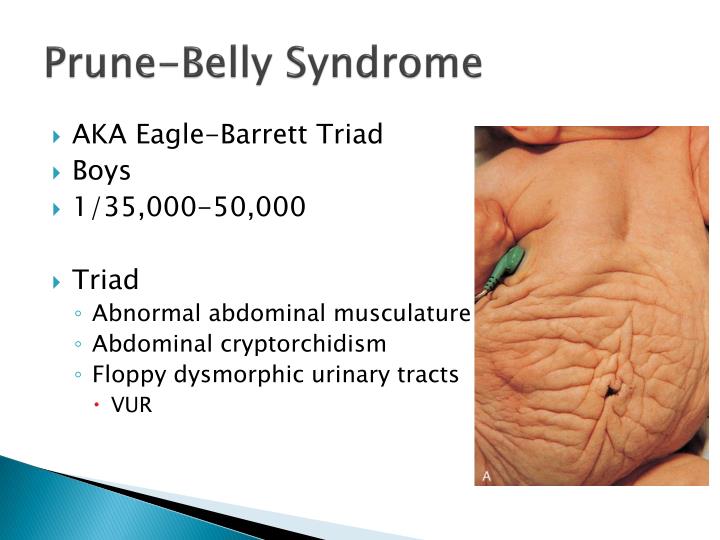 PPT Urology Board Review PowerPoint Presentation ID1415071